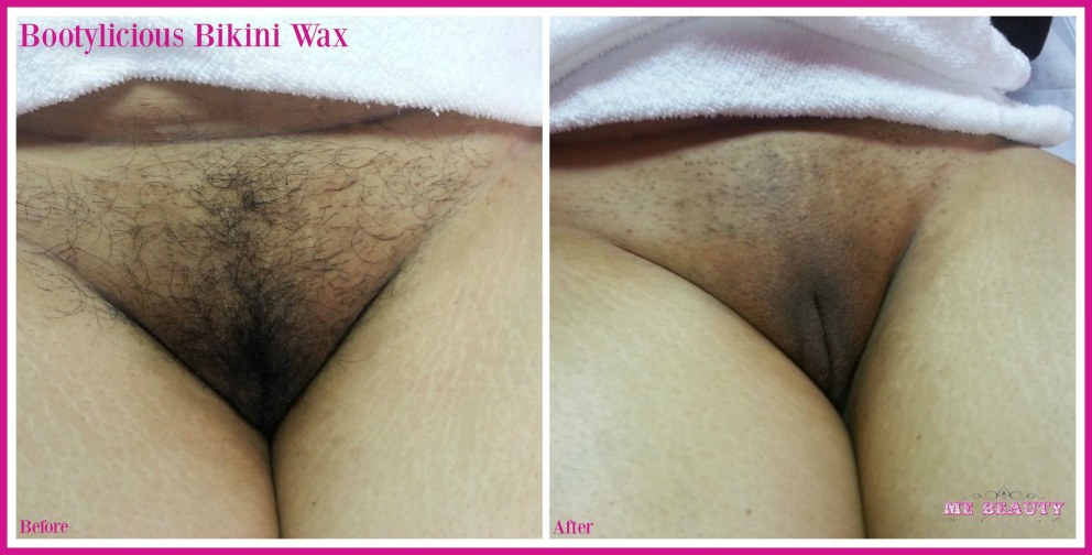 Глубокого бикини vagina xxx