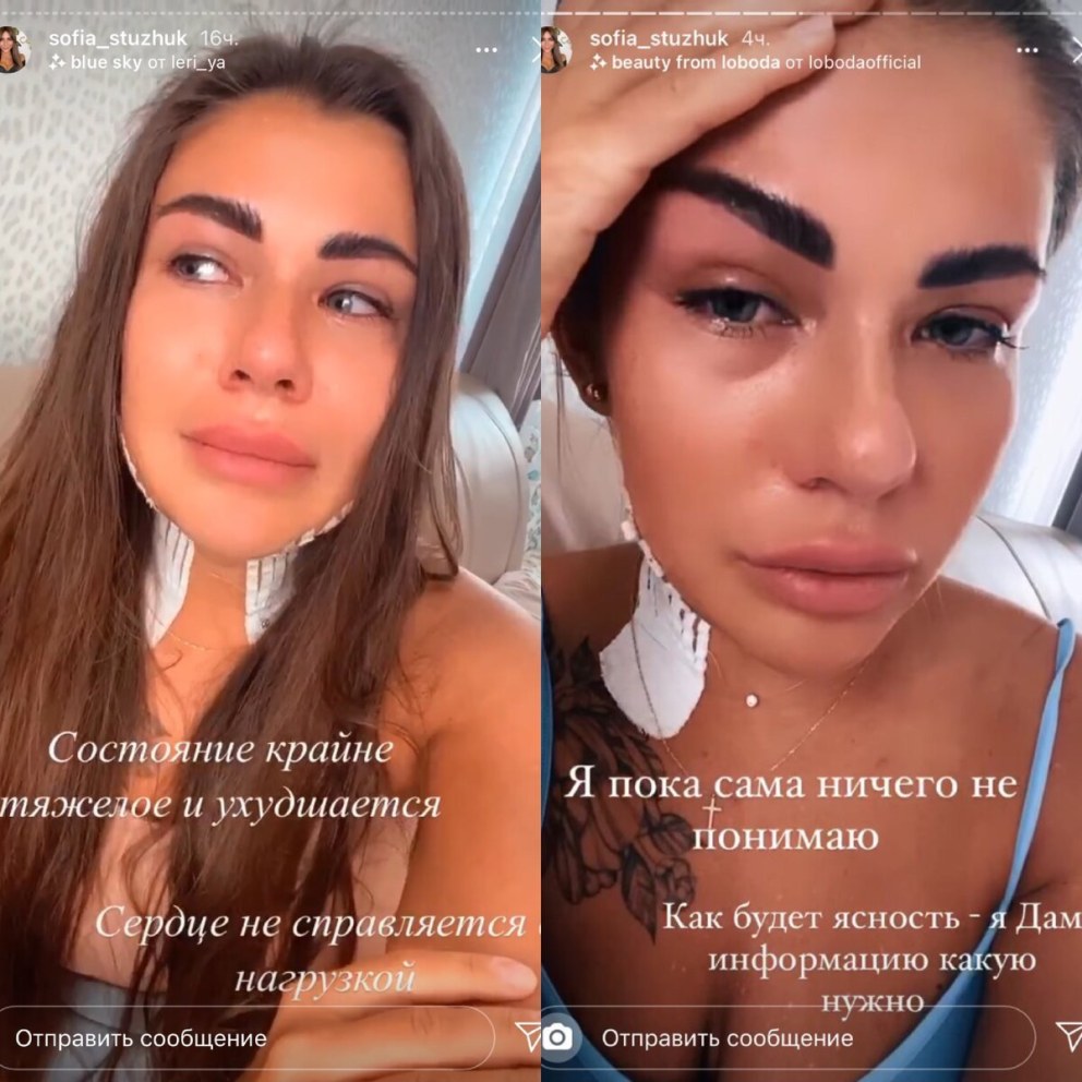 Фото до и после похудения для мотивации