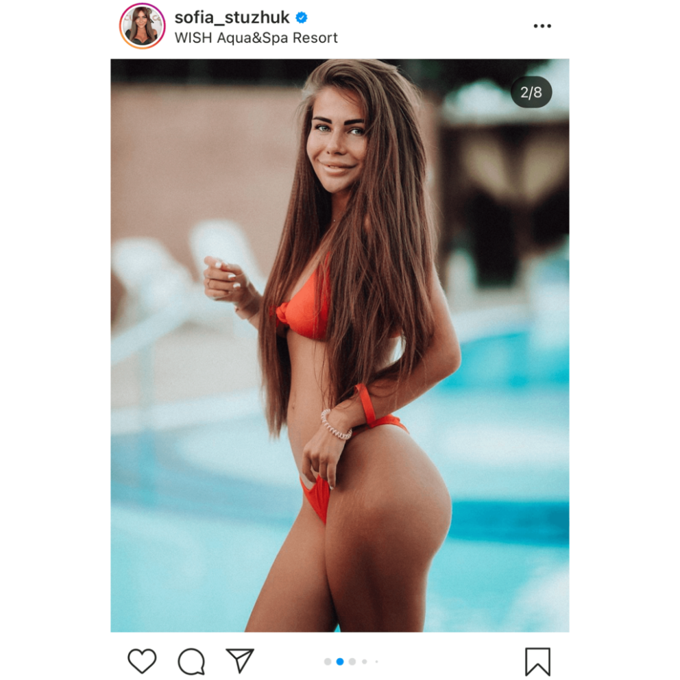 София Стужук до пластики