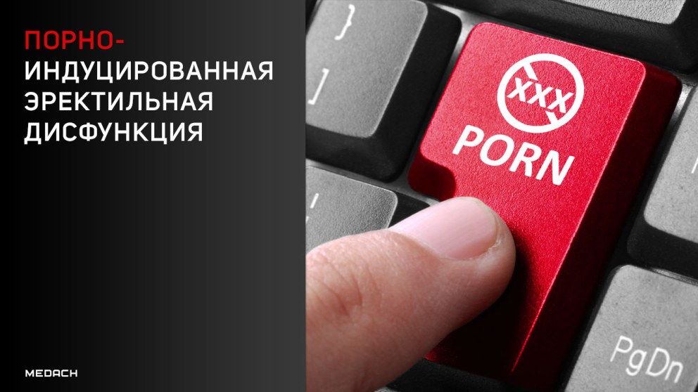 Прости Джон Гарфилд