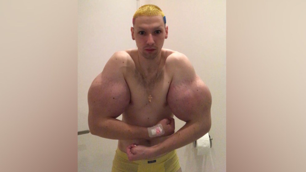 Кирилл Терешин без синтола
