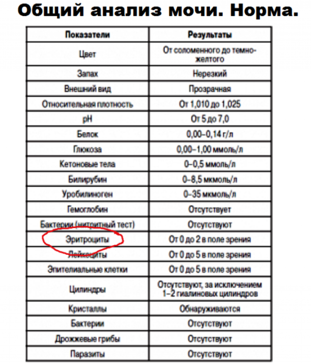 Девочка в Нижнем белье без лица